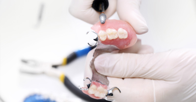 Implant mounted dentures